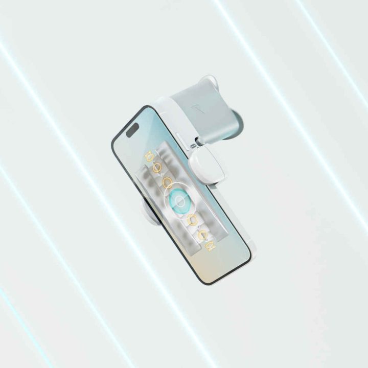 DentalMonitoring